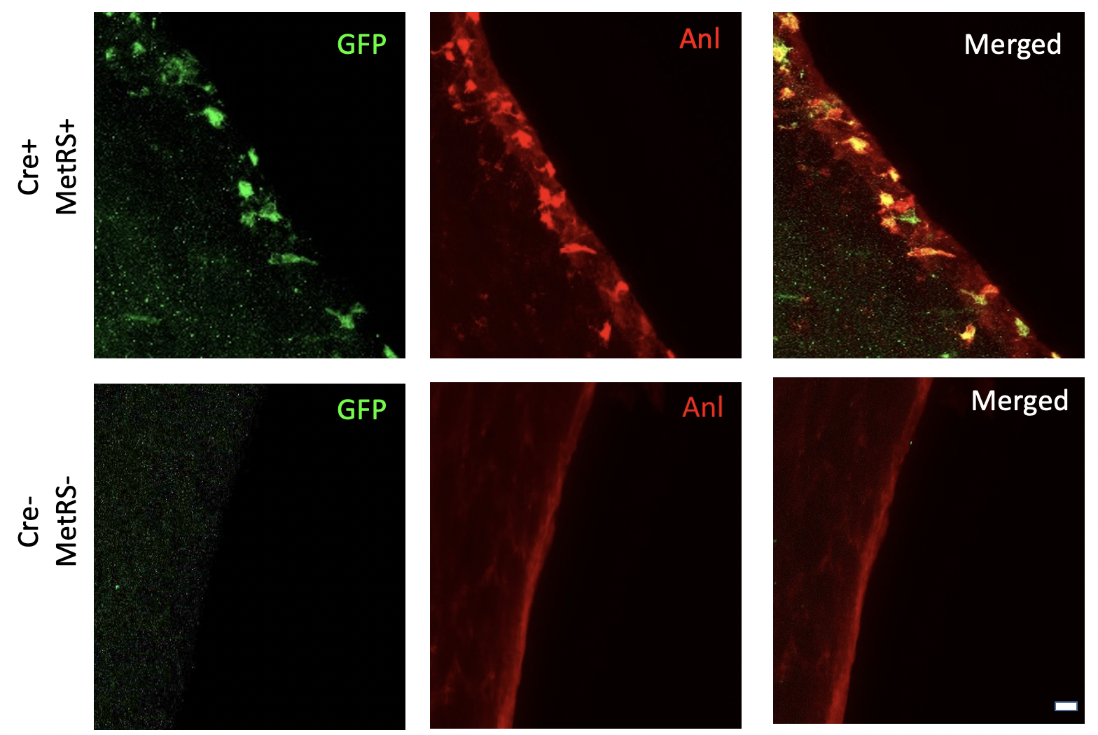 immunofluorescence imaging of anl-tagged proteins in GFP+ cells in the subventricular zone